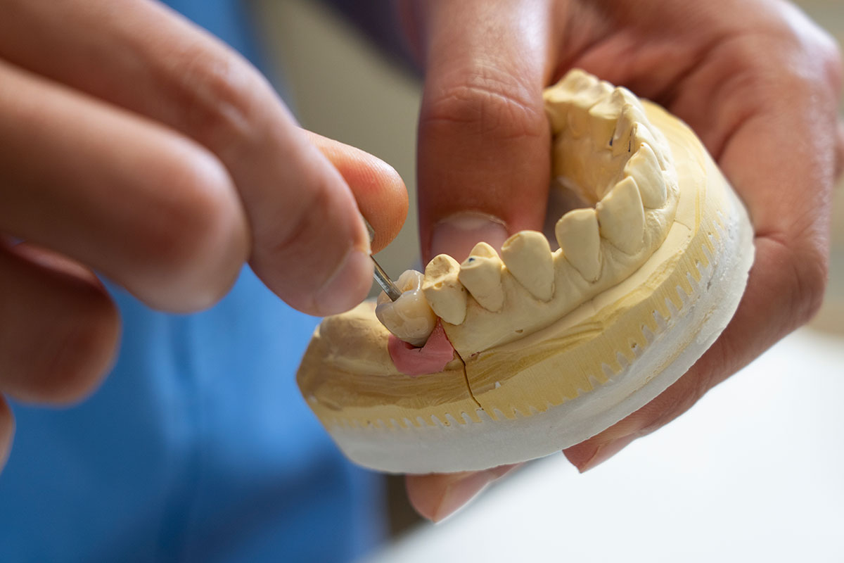 Implantologia dentale implantologia dentale