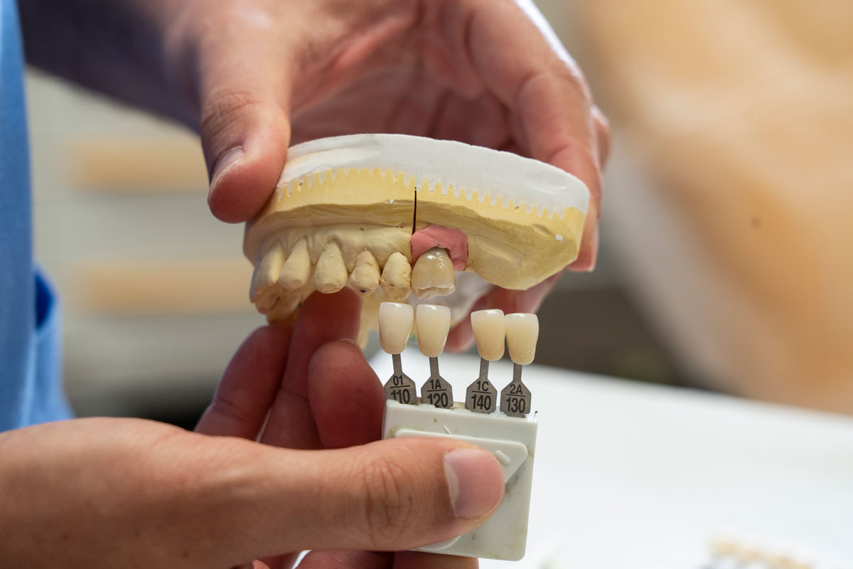 implantologia dentale