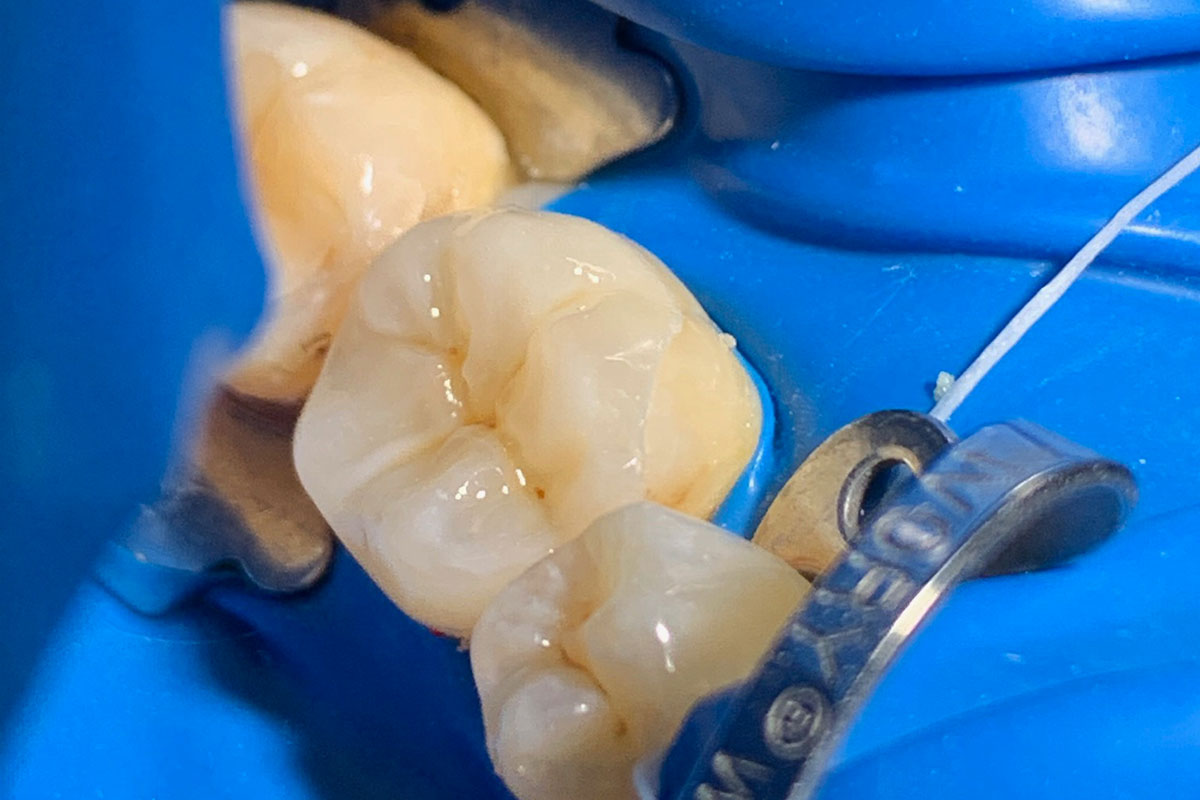odontoiatria conservativa